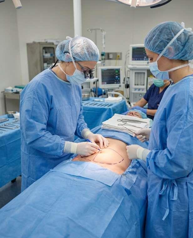 Abdominoplasti